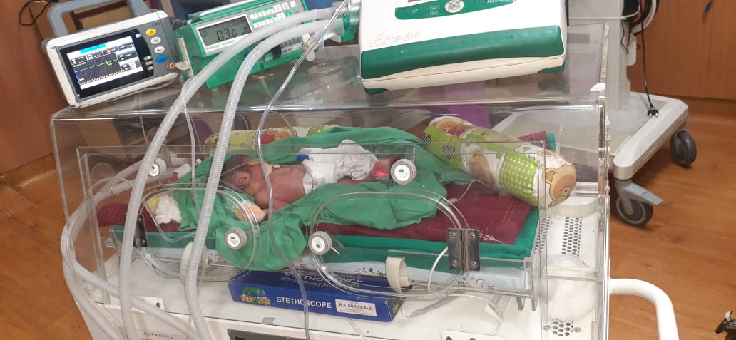 premature baby on incubator (5)