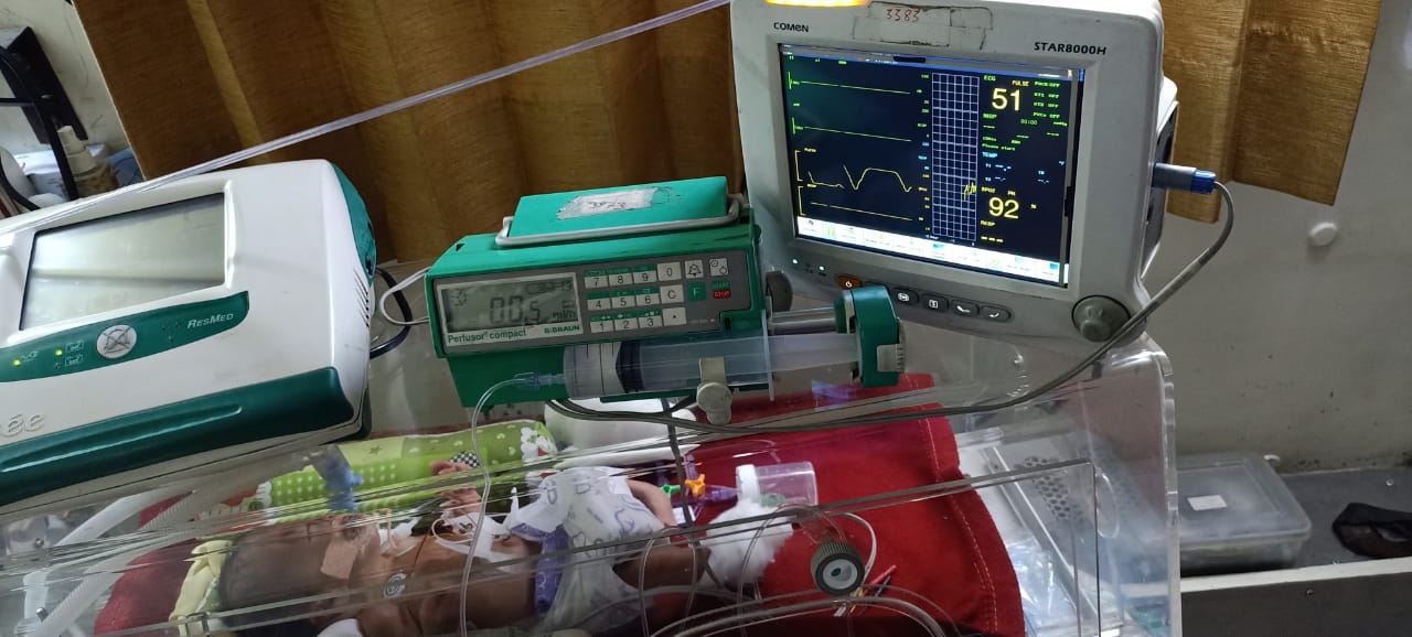 premature baby on incubator (9)