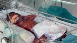 Nulife-Hospital-GTB-Nagar-New-Delhi-to-the-NICU-at-Safdarjung-Hospital-New-Delhi-Image-2025-06-30-at-3.40.16-PM-1